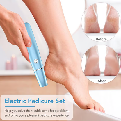 🔥Flash Sale - 50% OFF🔥Electric Foot Callus Remover⚡