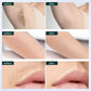 Portable Laser Hair Removal Device Set