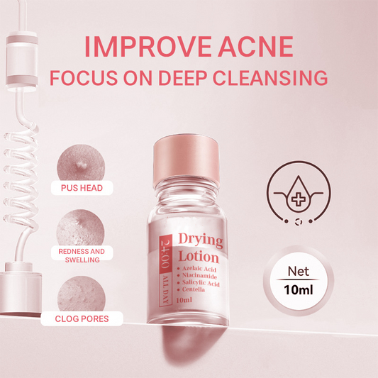 🎉Salicylic Acid Spot Drying Lotion✨